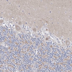 CXXC4 Antibody, Novus Biologicals 25 &mu;L | Buy Online | Novus Biologicals | Fisher Scientific